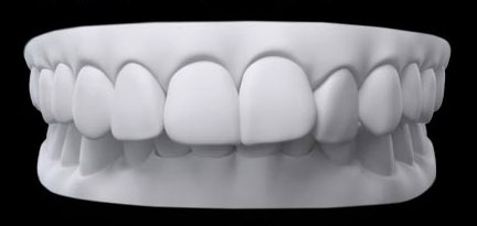 Mușcătură adâncă