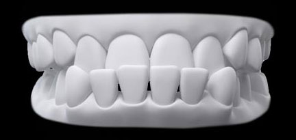 Mușcătură inversă