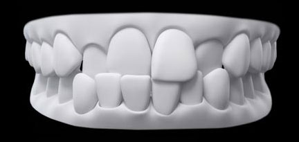 Un dinte sus sau în față